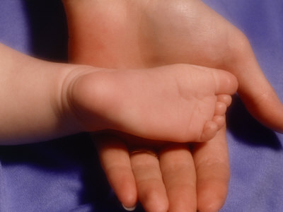 Baby's Foot by John Parnell Pricing Limited Edition Print image