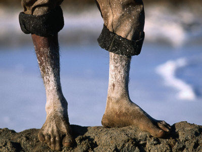 The Feet Of A Salt Worker, Gujarat, India by Jerry Galea Pricing Limited Edition Print image
