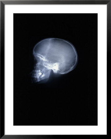 X-Ray Of Skull by Rick Kooker Pricing Limited Edition Print image