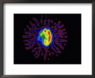 Nuclear Medicine-Gamma by David M. Dennis Pricing Limited Edition Print image