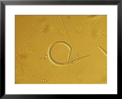 Nematode Trapping Fungus by London Scientific Films Pricing Limited Edition Print image