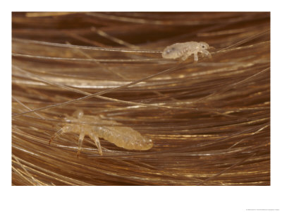 Head Lice Crawling Through Hair by Darlyne A. Murawski Pricing Limited Edition Print image