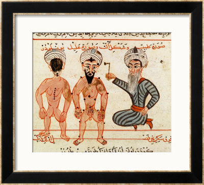 Cauterisation Of Leprosy Lesions, 1466 by Charaf-Ed-Din Pricing Limited Edition Print image