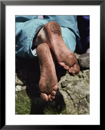 Close Up Of A Pilgrims Feet After Walking The Stations Of The Cross On Lough Derg by Sam Abell Pricing Limited Edition Print image