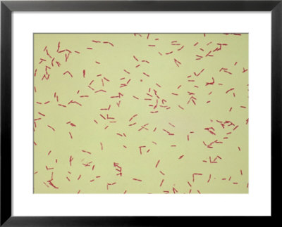 Legionella Pneumophilia by G. W. Willis Pricing Limited Edition Print image