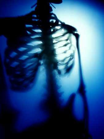 Blue Torso Of Human Skeleton by Images Monsoon Pricing Limited Edition Print image