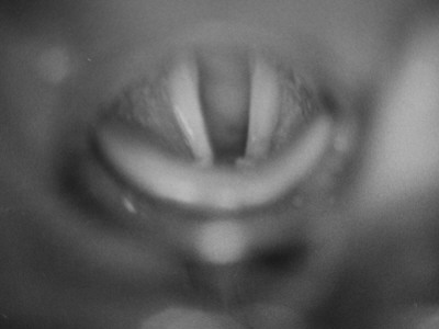 A View Of Vocal Cords From A Story Concerning The Northwestern University School Of Speech by Hansel Mieth Pricing Limited Edition Print image