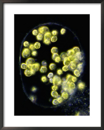 Green Algae, Characiosiphon, - A Large Multinucleated Coenocytis With Numerous Chloroplasts by Peter Siver Pricing Limited Edition Print image