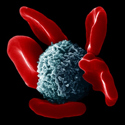 Macrophage by David Phillips Pricing Limited Edition Print image