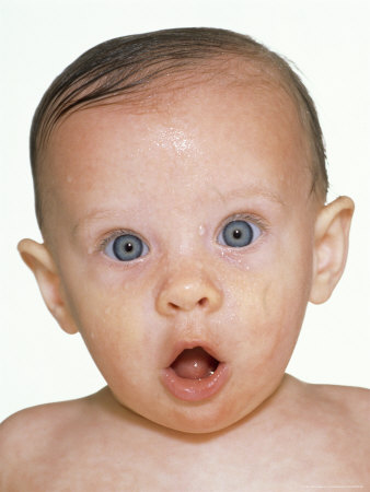 Portrait Of A Surprised Baby by Andrew Holden Pricing Limited Edition Print image