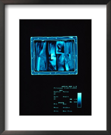 High-Tech X-Ray Images Made By An Actis (Advanced Computed Tomography Inspection System) by Sisse Brimberg Pricing Limited Edition Print image