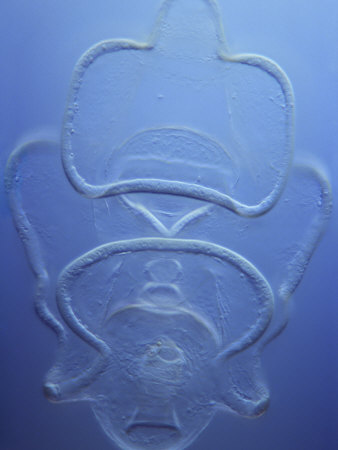 Planktonic Bipinnaria Larva Of The Common Starfish (Asterias Rubens) by Wim Van Egmond Pricing Limited Edition Print image