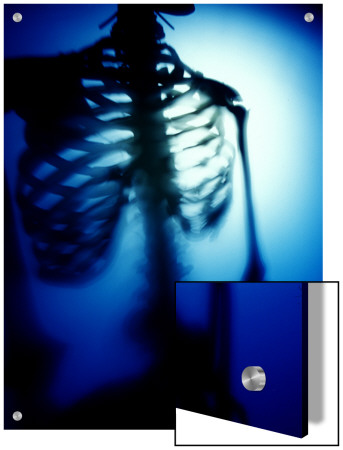 Blue Torso Of Human Skeleton by D.J. Pricing Limited Edition Print image