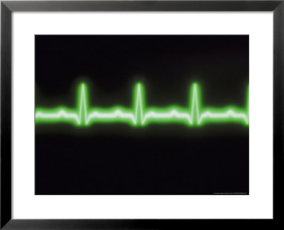 Electrocardiogram Trace by David M. Dennis Pricing Limited Edition Print image