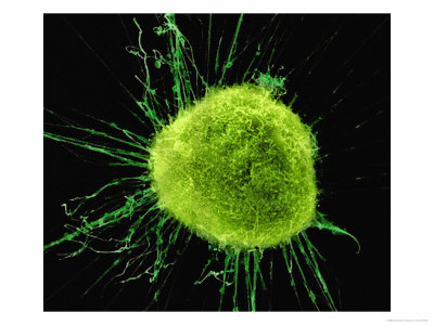 Cancer Cell, Electron Microscopy by Jacob Halaska Pricing Limited Edition Print image