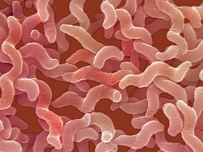 Campylobacter Jejuni by Dennis Kunkel Pricing Limited Edition Print image