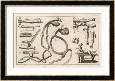 Diagram To Show The Various Methods Used For Opening Veins And Performing Blood Transfusions by Heister Pricing Limited Edition Print image