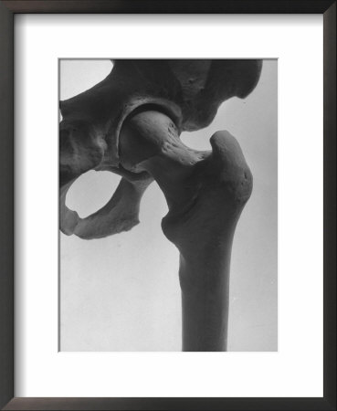 Skeletal Structures Of A Human Pelvis Universal Joint, With Rounded Knob Allowing The Leg To Swivel by Andreas Feininger Pricing Limited Edition Print image