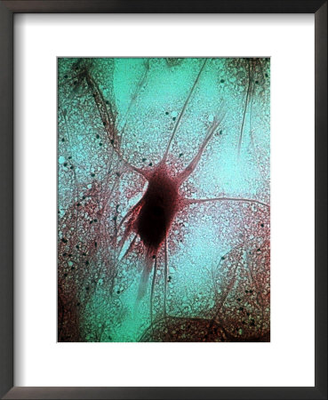 Nerve Cell (Neuron From Spinal Cord) by David M. Dennis Pricing Limited Edition Print image