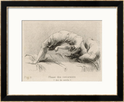 Mental Patient At La Salpetriere Going Through The Phase Of Contortions by P. Richer Pricing Limited Edition Print image