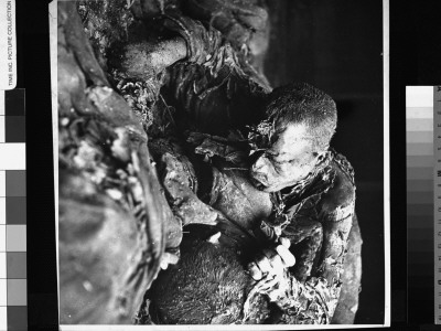 Ghastly Charred Head Of A Political Prisoner, Burned Alive By The Nazis by William Vandivert Pricing Limited Edition Print image