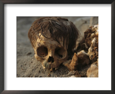 A Close View Of A Human Skull With The Hair Still Attached by Ira Block Pricing Limited Edition Print image