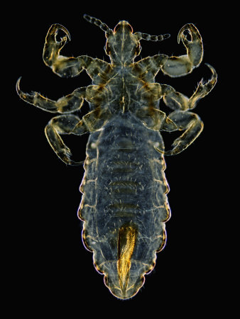 Head Louse. Darkfield Lm by Wim Van Egmond Pricing Limited Edition Print image