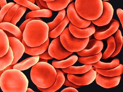 Human Red Blood Cells Or Erythrocytes by Dennis Kunkel Pricing Limited Edition Print image