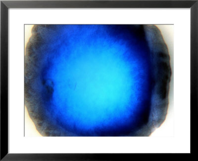 Mycobacterium Xenopi by Dr. Luis De La Maza Pricing Limited Edition Print image