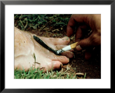 Buffalo Leech On Foot, Malaysia by Oxford Scientific Pricing Limited Edition Print image