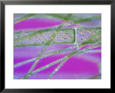 Eucaryotica Algae, Rhizoclonium Species, Chloroplasts Visible by Sinclair Stammers Pricing Limited Edition Print image