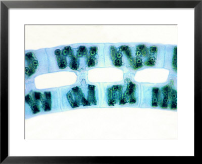 Green Algae Spirogyra Undergoing Conjugation by David M. Dennis Pricing Limited Edition Print image