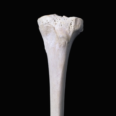 Front, Upper End Of Left Tibia. by Ralph Hutchings Pricing Limited Edition Print image