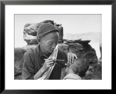 Chinese Man Performing An Acupuncture On A Man's Ear by Carl Mydans Pricing Limited Edition Print image