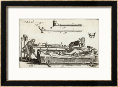 Surgeons Setting A Bone With The Help Of Michault's Bone- Setting Apparatus by E.A. Sohn Pricing Limited Edition Print image