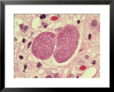 Toxoplasma Gondii, H&E Stain/252X by G. W. Willis Pricing Limited Edition Print image