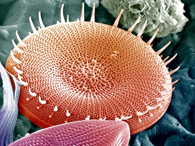 Diatom, A Unicellular Algae. by Stanley Flegler Pricing Limited Edition Print image