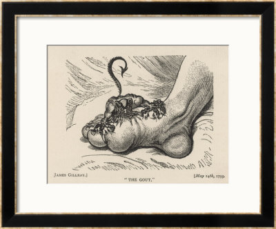 Little Devil Sinks His Teeth Into The Swollen Foot Of A Gout Sufferer by James Gillray Pricing Limited Edition Print image