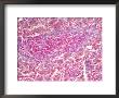 Anthrax, Bacillus Anthracis & Red Infected Cells In Animal Tissue by Kent Wood Limited Edition Print