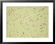 Legionella Pneumophilia by G. W. Willis Limited Edition Print