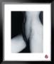 Netztorso Ii, 1993 by Gunter Blum Limited Edition Print
