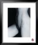 Netztorso Ii, 1993 by Günter Blum Limited Edition Pricing Art Print