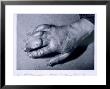 Dr. Atkinson's Frost-Bitten Hand, 1911 by Herbert Ponting Limited Edition Pricing Art Print