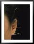 Close View Of Woman Receiving Acupuncture Treatment Around Her Ears by O. Louis Mazzatenta Limited Edition Pricing Art Print