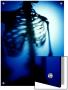 Blue Torso Of Human Skeleton by D.J. Limited Edition Print