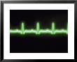 Electrocardiogram Trace by David M. Dennis Limited Edition Print