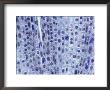 Mitosis In Onion Root Tip Cells by David M. Dennis Limited Edition Print