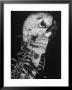 Startling Papier-Mache Model Of Human Skull Exhibited By Clay-Adams Co by Margaret Bourke-White Limited Edition Print