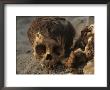 A Close View Of A Human Skull With The Hair Still Attached by Ira Block Limited Edition Print