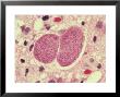 Toxoplasma Gondii, H&E Stain/252X by G. W. Willis Limited Edition Print